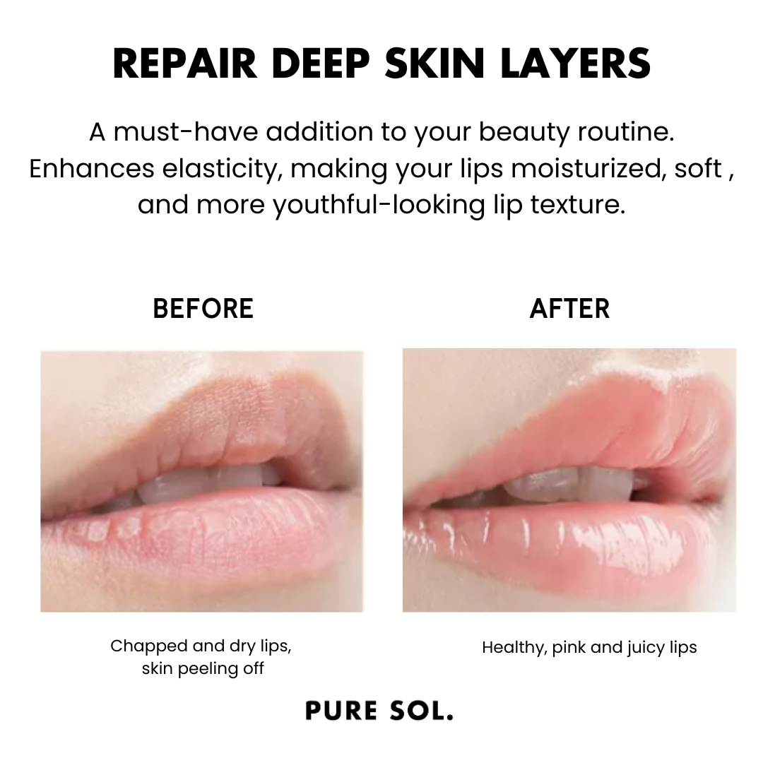 PURESOL Pucker Up Cherry Blossom Hydrogel Lip Masks — 6 Pack